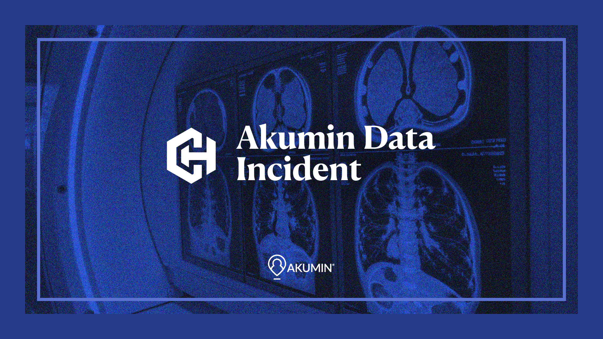 Akumin Data Incident Settlement Header Image